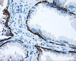 m00712 1 anti mcl1 mouse monoclonal antibody clone id oti10f6 ihc testing 4