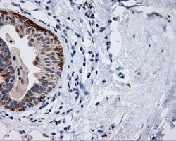 m00712 1 anti mcl1 mouse monoclonal antibody clone id oti10f6 ihc testing 5