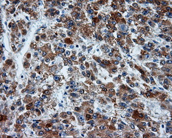 m00712 1 anti mcl1 mouse monoclonal antibody clone id oti10f6 ihc testing 8