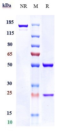 Anti-ANO1/TMEM16A Reference Antibody (Novartis patent anti-TMEM16A 	) on SDS-PAGE under reducing (R) condition