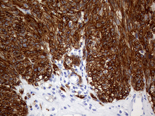 m00713 anti tmem16a ano1 mouse monoclonal antibody clone id oti5h7 ihc testing 2