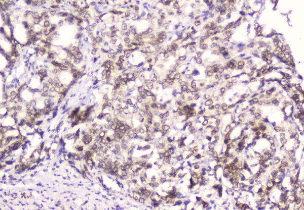 m00714 emerin primary antibodies ihc testing 2