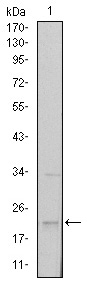 Western blotting validation for Anti-SNAI 1 Monoclonal Antibody M00716
Western Blot (WB) analysis using SNAI 1 Monoclonal Antibody against NTERA-2 cell lysate