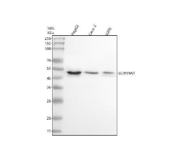 Western blot analysis of SERPINA1 using anti-SERPINA1 antibody (M00720-1)