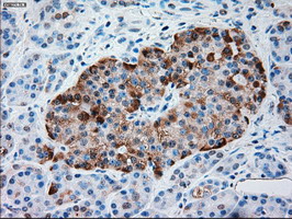 m00720 3 anti alpha 1 antitrypsin serpina1 mouse monoclonal antibody clone id oti9a1 ihc testing 4