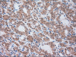 m00720 3 anti alpha 1 antitrypsin serpina1 mouse monoclonal antibody clone id oti9a1 ihc testing 5