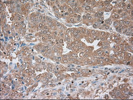 m00720 3 anti alpha 1 antitrypsin serpina1 mouse monoclonal antibody clone id oti9a1 ihc testing 6