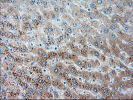 m00720 3 anti alpha 1 antitrypsin serpina1 mouse monoclonal antibody clone id oti9a1 ihc testing 7