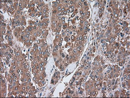 m00720 3 anti alpha 1 antitrypsin serpina1 mouse monoclonal antibody clone id oti9a1 ihc testing 8
