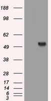 HEK293T cells were transfected with the pCMV6-ENTRY control (Left lane) or pCMV6-ENTRY SERPINA1 (Right lane) cDNA for 48 hrs and lysed