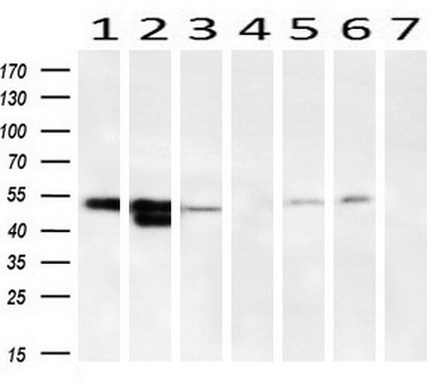 Western blot analysis of extracts (10ug) from 7 Human tissue by using anti-SERPINA1 monoclonal antibody ( 1: Uterus; 2: Breast; 3: Brain; 4: Liver; 5: Ovary; 6: Thyroid gland; 7: colon) at 1:200 dilution