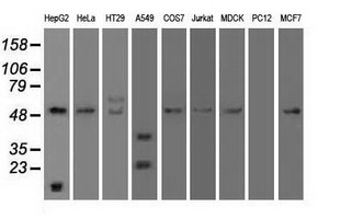 Western blot analysis of extracts (35ug) from 9 different cell lines by using anti-SERPINA1 monoclonal antibody