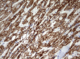 m00721 anti ornithine carbamoyltransferase otc mouse monoclonal antibody clone id oti8a1 ihc testing 2