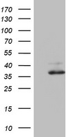 m00721 anti ornithine carbamoyltransferase otc mouse monoclonal antibody clone id oti8a1 wb testing 1