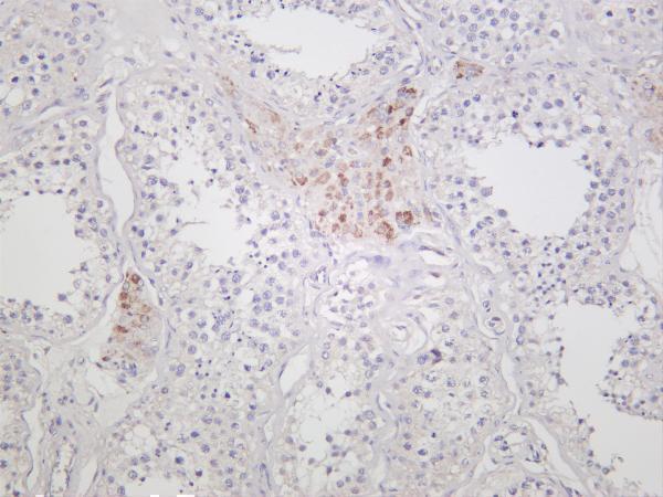Human testis was stained with anti-ROCK1 rabbit antibody