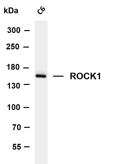 Various whole cell lysates were separated by 4-8% SDS-PAGE, and the membrane was blotted with anti-ROCK1 antibody
