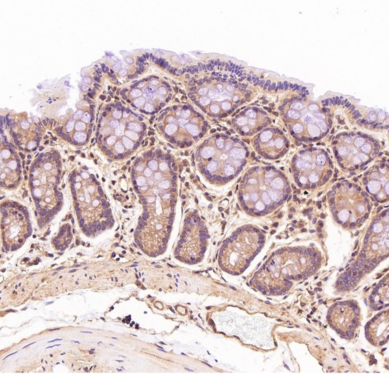 Immunohistochemical analysis of paraffin-embedded Rat stomach, using the Antibody at 1:150 dilution