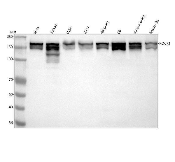  Western blot analysis of FROCK1 using anti-ROCK1 antibody (M00722)