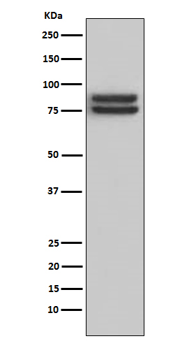 Western blot analysis of FOXP1 expression in Daudi cell lysate