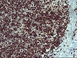 Immunohistochemical staining of paraffin-embedded Human lymph node tissue within the normal limits using anti-FOXP1 mouse monoclonal antibody at 1:150 (M00723-2)