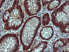 m00723 2 anti foxp1 mouse monoclonal antibody clone id oti4f1 ihc testing 12