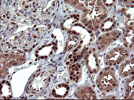 m00723 2 anti foxp1 mouse monoclonal antibody clone id oti4f1 ihc testing 13