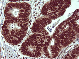 m00723 2 anti foxp1 mouse monoclonal antibody clone id oti4f1 ihc testing 4