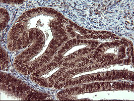 m00723 2 anti foxp1 mouse monoclonal antibody clone id oti4f1 ihc testing 6