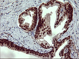 m00723 2 anti foxp1 mouse monoclonal antibody clone id oti4f1 ihc testing 7