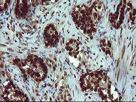 m00723 2 anti foxp1 mouse monoclonal antibody clone id oti4f1 ihc testing 9