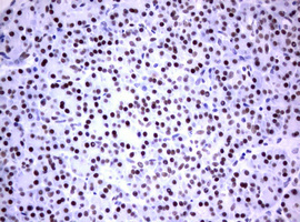 Immunohistochemical staining of paraffin-embedded Human pancreas tissue within the normal limits using anti-FOXP1 mouse monoclonal antibody