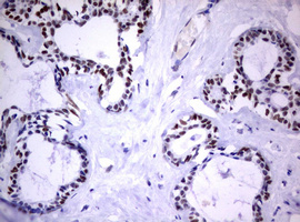 Immunohistochemical staining of paraffin-embedded Human breast tissue within the normal limits using anti-FOXP1 mouse monoclonal antibody