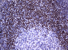 m00723 3 anti foxp1 mouse monoclonal antibody clone id oti3g3 ihc testing 4