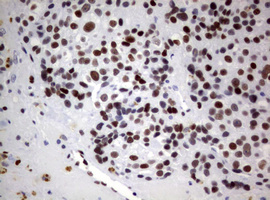m00723 3 anti foxp1 mouse monoclonal antibody clone id oti3g3 ihc testing 5