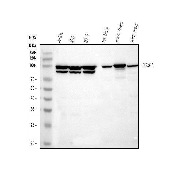  Western blot analysis of FOXP1 using anti-FOXP1 antibody (M00723)