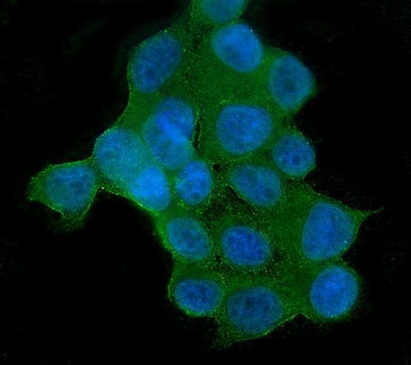 m00725 1 akt2 primary antibodies if testing 2