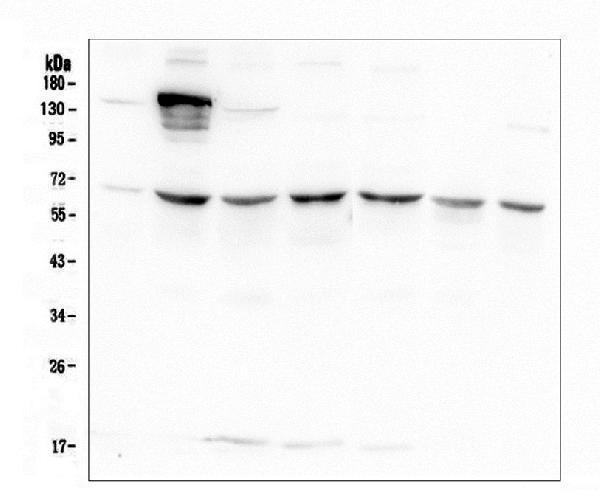 m00725 1 akt2 primary antibodies wb testing 1