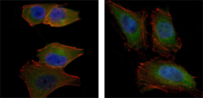 Immunofluorescence analysis of PANC-1 (left) and Hela (right) cells using Akt2 Monoclonal Antibody (green)