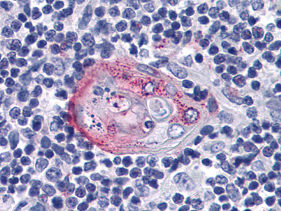 Immunohistochemistry analysis of paraffin-embedded human Thymus tissues with AEC staining using Akt2 Monoclonal Antibody