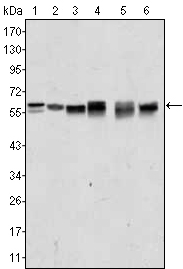 Western Blot analysis using Akt2 Monoclonal Antibody against A431 (1), Jurkat (2), HEK293 (3), A549 (4), MCF-7 (5) and PC-12 (6) cell lysate