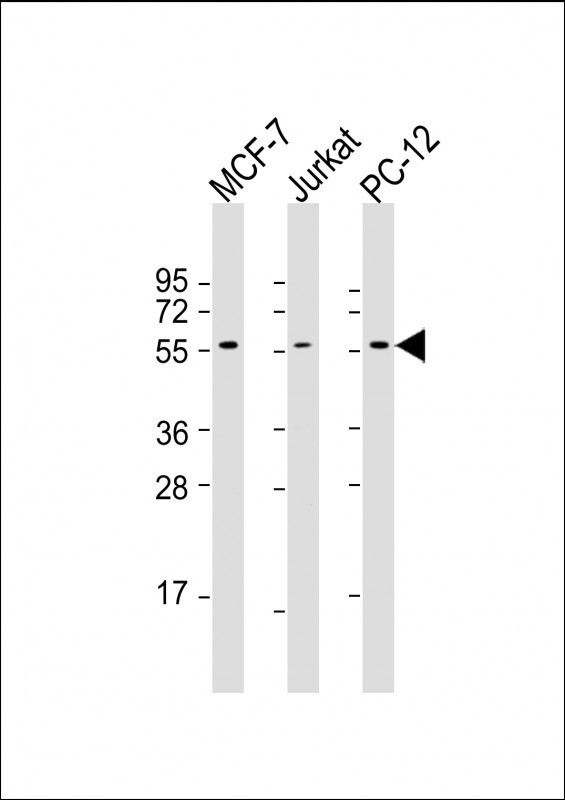 All lanes : Anti-AKT2 Antibody at 1:1000-1:2000 dilutionLane 1: MCF-7 whole cell lysateLane 2: Jurkat whole cell lysateLane 3: PC-12 whole cell lysateLysates/proteins at 20 µg per lane