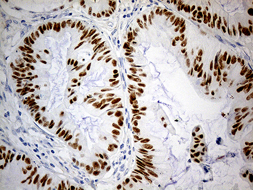 m00727 anti klf5 mouse monoclonal antibody clone id oti6d2 ihc testing 3