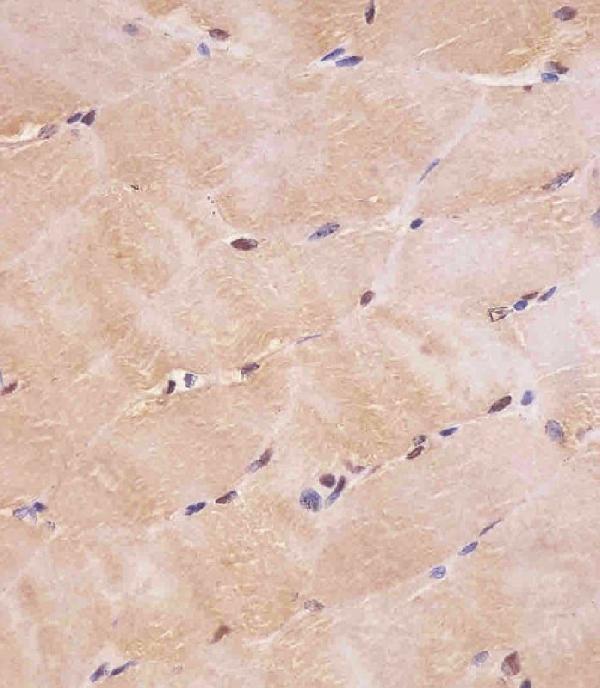 M00728-3 staining SMAD1 in human skeletal muscle tissue sections by Immunohistochemistry (IHC-P -paraformaldehyde-fixed, paraffin-embedded sections)