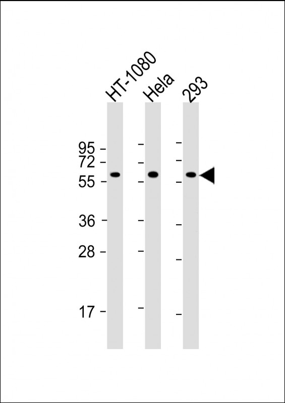 All lanes : Anti-SMAD1 Antibody at 1:2000 dilutionLane 1: HT-1080 whole cell lysateLane 2: Hela whole cell lysateLane 3: 293 whole cell lysateLysates/proteins at 20 µg per lane