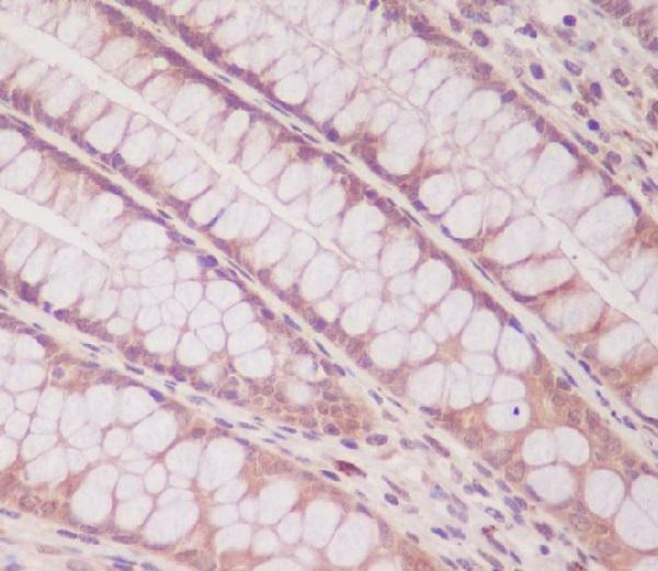 Immunohistochemical analysis of paraffin-embedded human colon, using Smad1 Antibody