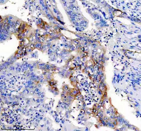 IHC analysis of L1CAM using anti-L1CAM antibody (M00729)