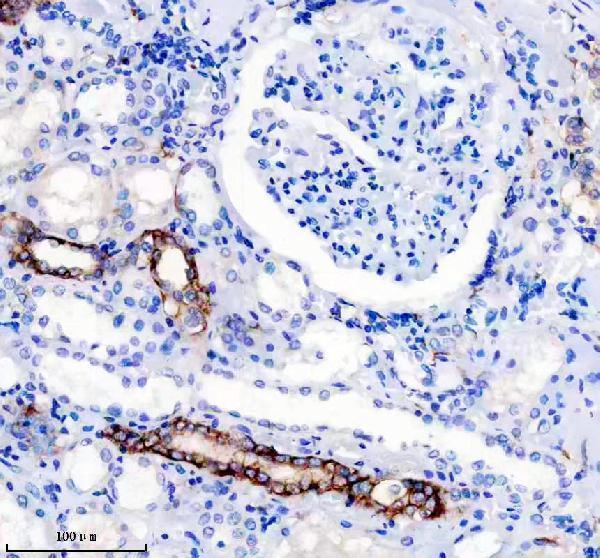 IHC analysis of L1CAM using anti-L1CAM antibody (M00729)
