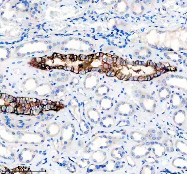 m00729 l1cam primary antibodies ihc testing 3