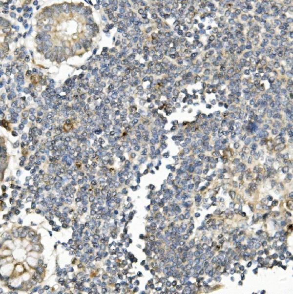  IHC analysis of Bid using anti-Bid antibody (M00730-1)