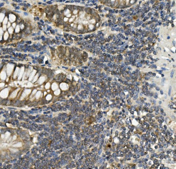  IHC analysis of Bid using anti-Bid antibody (M00730-1)